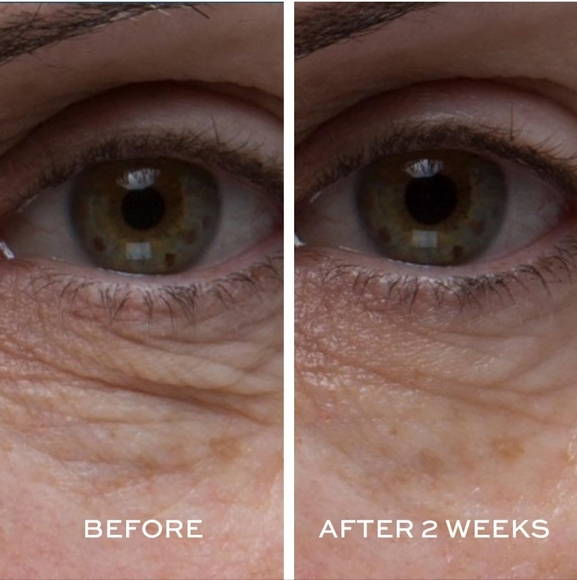 Elemis Peptide4 Eye Recovery Cream, NIB - Picture 3 of 4